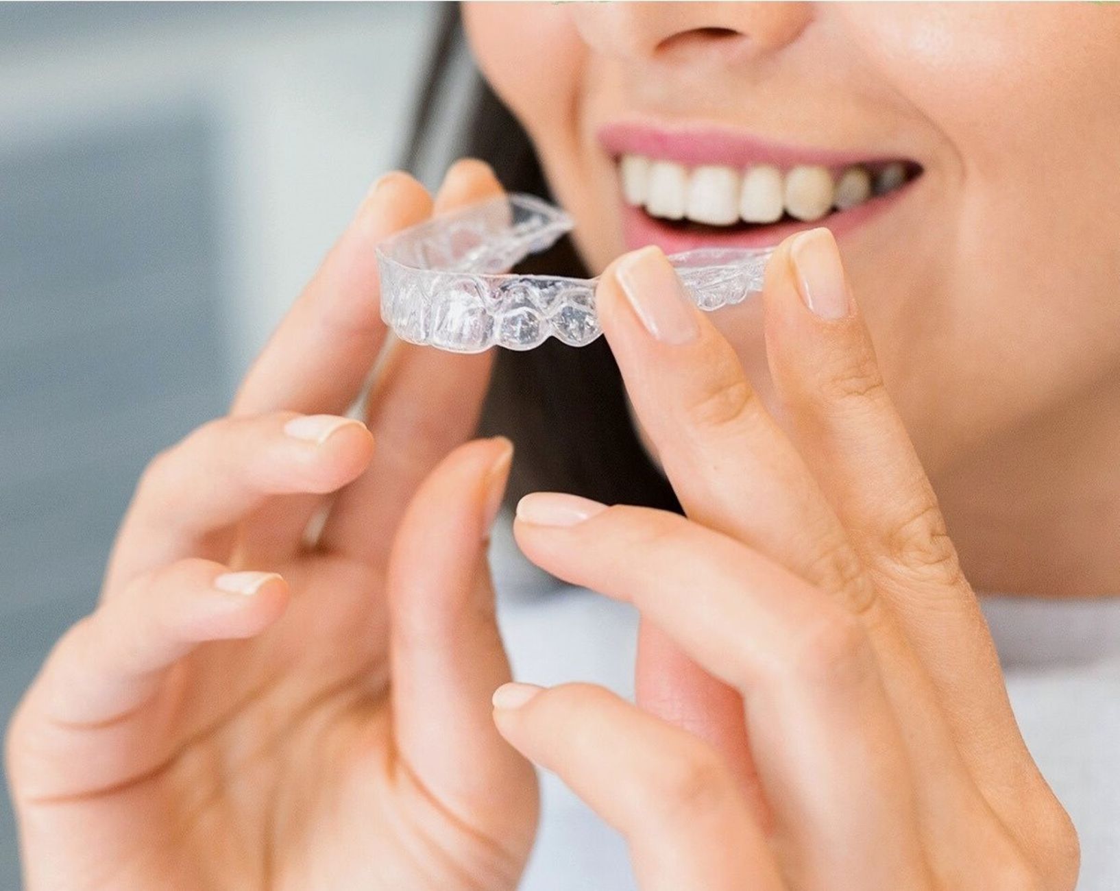 Invisalign onzichtbare beugels